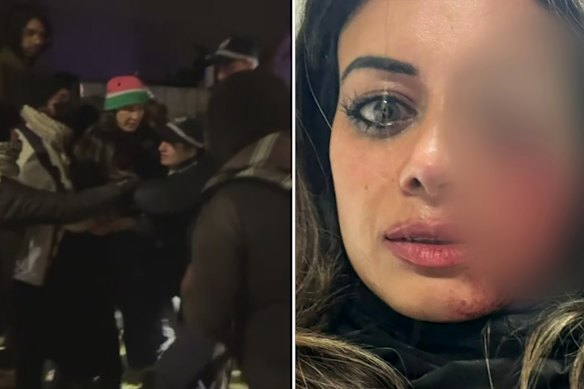 Hannah Thomas, a former Greens candidate, suffered a serious injury to her eye after police broke up a protest in Sydney’s south-west.