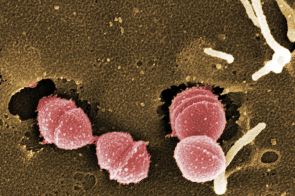 Because it is a bacteria, strep A (pictured) can be treated with antibiotics, but there is not currently a vaccine against it.