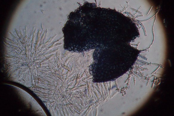 Fusarium graminearum causes head blight in wheat and other cereals.