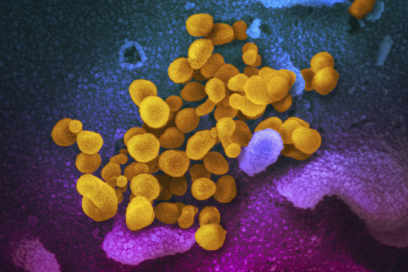 This undated electron microscope image made available by the US National Institutes of Health in February 2020 shows the novel coronavirus SARS-CoV-2, yellow, emerging from the surface of cells, blue/pink, cultured in the lab.