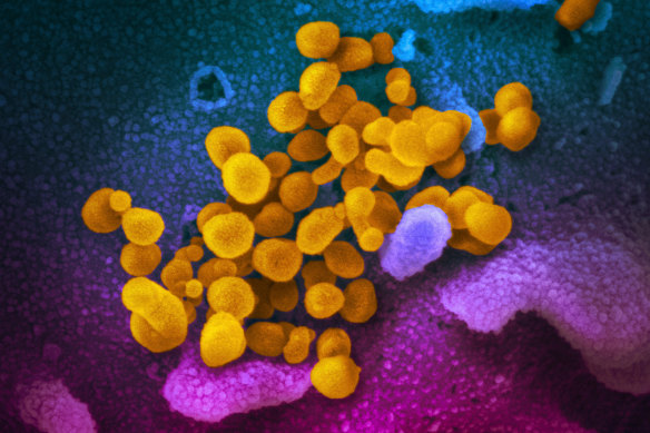 This undated electron microscope image made available by the US National Institutes of Health in February shows the SARS-CoV-2 virus. There is now good evidence the British variant is about 70 per cent more contagious.