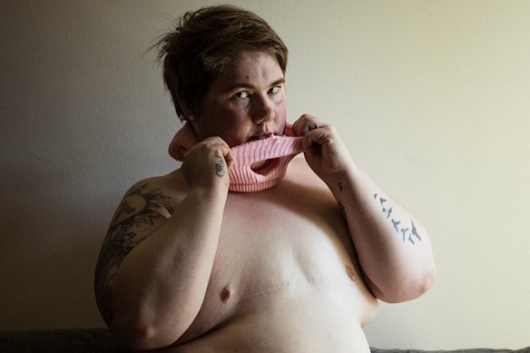 In this award-winning portrait by Chris Hopkins, Mel Jefferies makes a statement about her feelings about her body post surgery. 