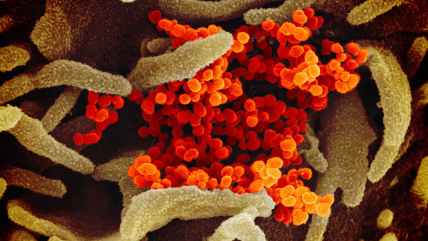 A microscope image shows a sample of the virus (in orange) that was isolated from a patient.