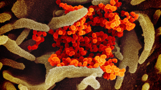 A scanning electron microscope image shows a sample of COVID-19 isolated from a patient.