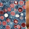 Mpox is a serious infectious disease.