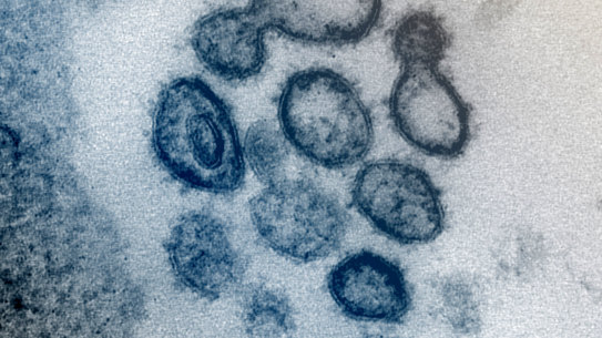 Data about what is possible to fight SARS-CoV-2 is mounting.