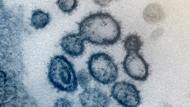 An electron microscope image of the virus that causes COVID-19.