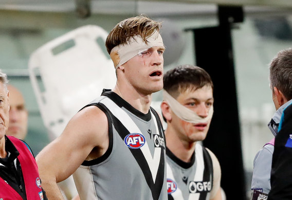 Tom Jonas and Zak Butters get taped up after their head clash.