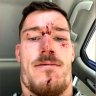 Two police officers charged with assaulting NRL star