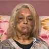 Ninette Simons is still recovering after the terrifying ordeal on April 17.