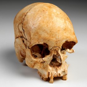 Luzia's 11,500-year-old skull was found along with her thigh and hip bones 1975. She is believed to have died aged 25. 