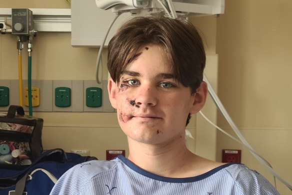Wyatt Kauffman in hospital after surviving the 30m fall at the Grand Canyon.