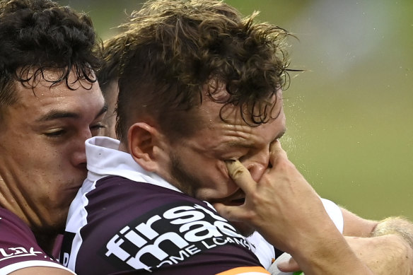 Ethan O’Neill suffered a fractured eye socket from this accidental poke from Bailey Hodgson.