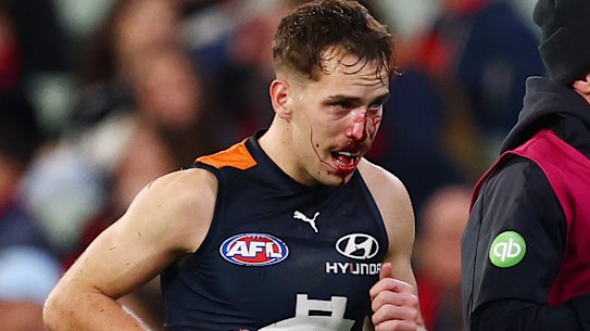 Francis Evans lost a tooth in the incicent. 