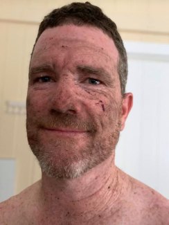 Innes Larkin after fighting the bushfires in November 2019