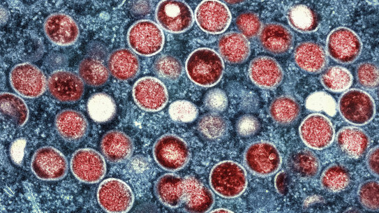 A colorised transmission electron micrograph of monkeypox particles, which are red.