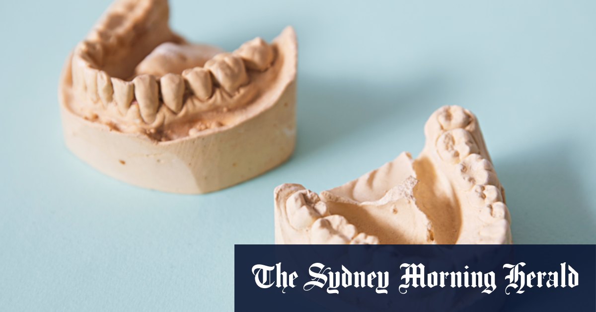 Teeth clenching and grinding: How your teeth can show if you're stressed - Vimarsana News