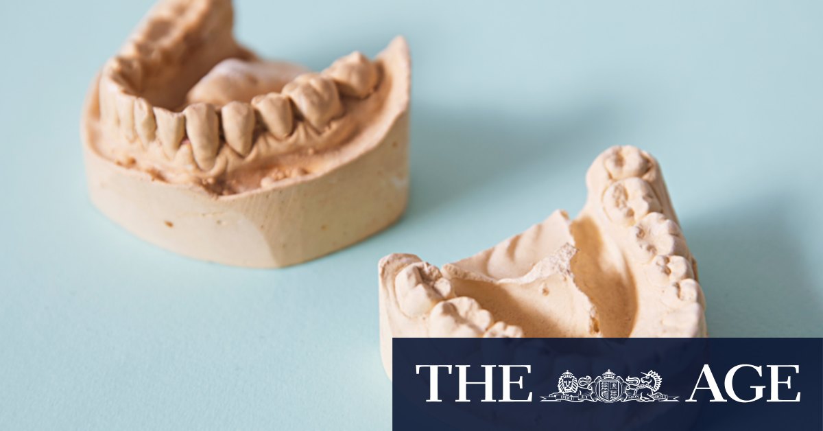 Teeth clenching and grinding: How your teeth can show if you're stressed - Vimarsana News