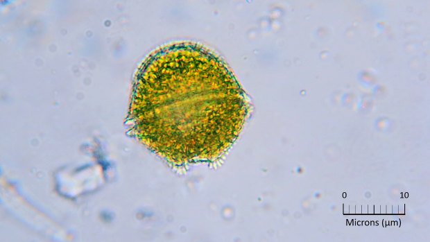 Alexandrium minutum is normally found in clean water off the coast, but was detected this month in the Shoalhaven River. 