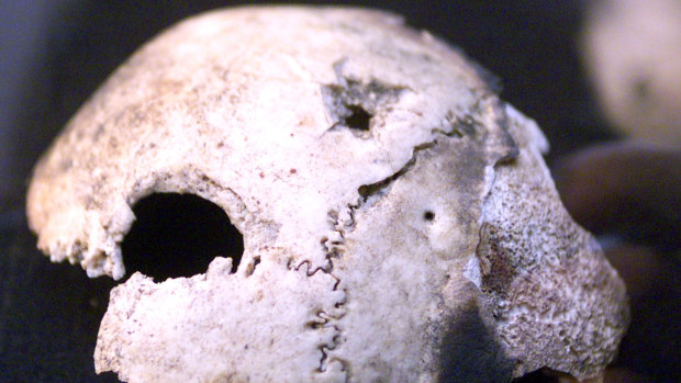 Hitler's supposed skull.