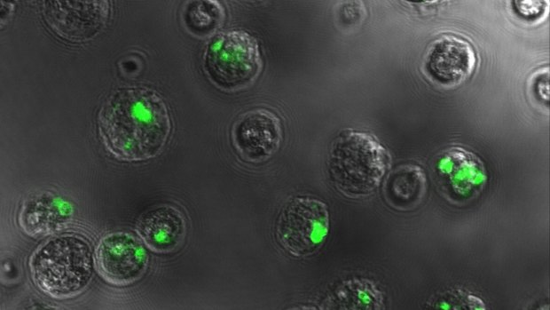 Researchers have shown the protein NKG7 (shown in green inside immune cells)  attacks cancer cells but also causes inflammation.