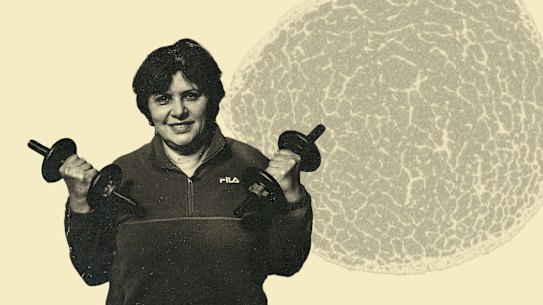 Elaine Cotter: “I’m now doing a kind of exercise that doesn’t leave me bedridden for a couple of days.”