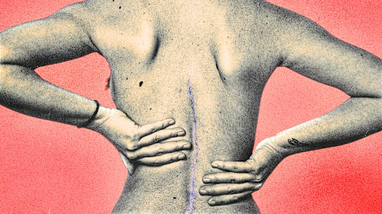 Most people know scars need to be kept hydrated, but exactly which moisturisers should we be using?