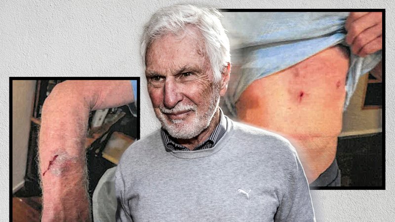 Photos reveal Mick Malthouse’s injuries after fighting off would-be intruders