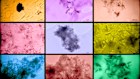 Shards of microplastic captured in kidney, liver and brain samples.