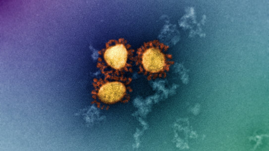 Omicron negative stain images created at the Doherty Institute.                   

Credit: Dr Jason A. Roberts, Head, Electron Microscopy and Structural Virology, Doherty Institute
” Transmission electron micrograph of negative-stained SARS-CoV-2 omicron variant virions, false-coloured.