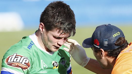Man down: In-form Raider John Bateman suffered a suspected fractured eye socket.