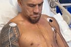 Sonny Bill Williams after surgery.