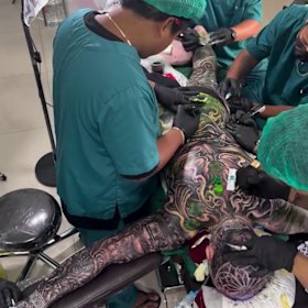 A full-body tattoo under general anaesthesia in Bali can cost around $16,000.