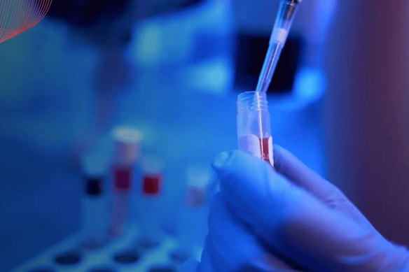 Proteomics International has expanded IP protection for its innovative PromarkerEso blood test - a simple, non-invasive early diagnostic technology that could save countless lives.