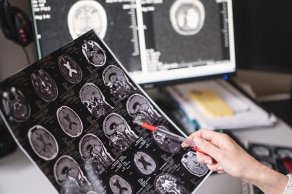 Ceretas Ltd has debuted on the ASX following a $8 million IPO for its revolutionary Alzheimer’s and Demensia ultrasound therapy technology.