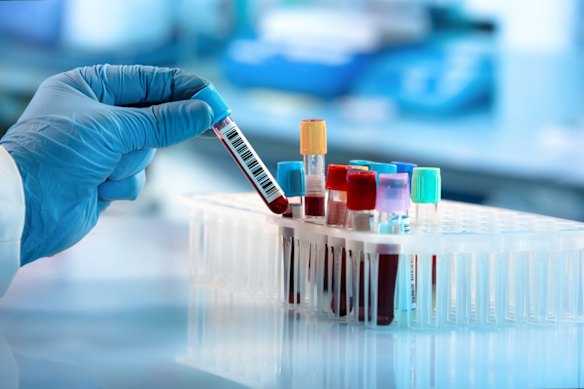 Proteomics International says its PromarkerEndo blood test could provide early screening for endometriosis, a condition that affects one in nine women.