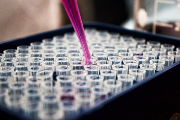 Newly published results from Proteomics International have revealed its PromarkerEso blood test can detect early oesophageal cancer with 91 per cent accuracy.