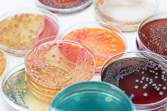Microbial growth growing inside a petri dish