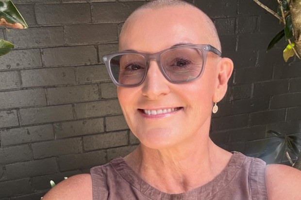 Cassandra Thorburn shaved her head after losing most of her hair to cancer treatment.
