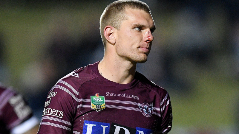 Kangaroos dream over with Tom Trbojevic set to have surgery on cheekbone