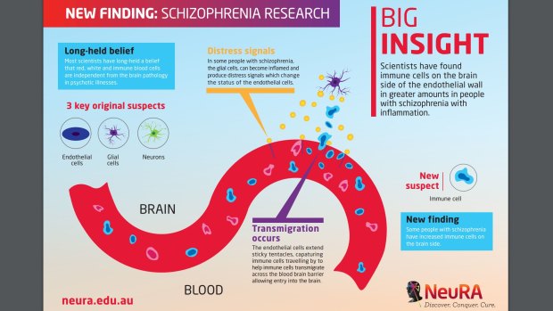 NeuRA scientists have found immune cells in the brains of people with 'high inflammation' schizophrenia.