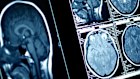 Kailo Medical’s pitch to radiologists is that it slashes reporting times, improves accuracy, eliminates paper forms and improves referrer loyalty.