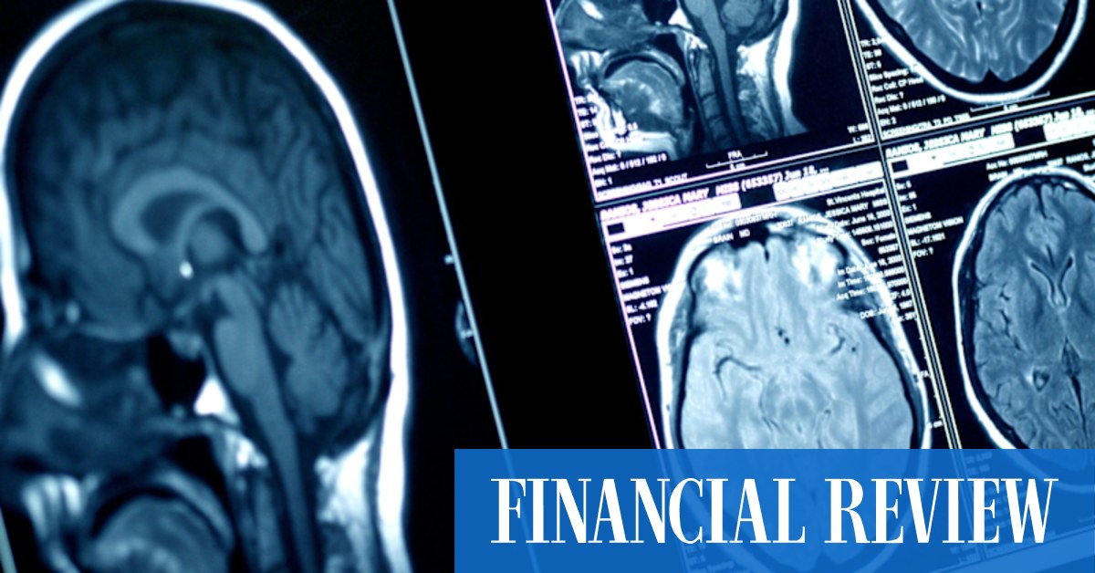 afr.com - Sarah Thompson, Kanika Sood, Emma Rapaport - Advent stitches up $700m merger for Imaging Associates, taps UBS