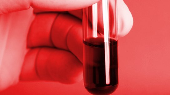 CSL will take a hit after moving to a direct distribution model in  China. 