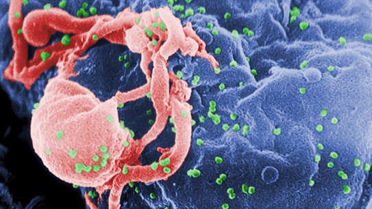 A scanning electron micrograph of multiple round bumps of the HIV-1 virus on a cell surface.