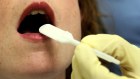 The DNA screening test, which has been developed by researchers at Monash University, will be free and involves just sending a saliva sample in the mail for testing.