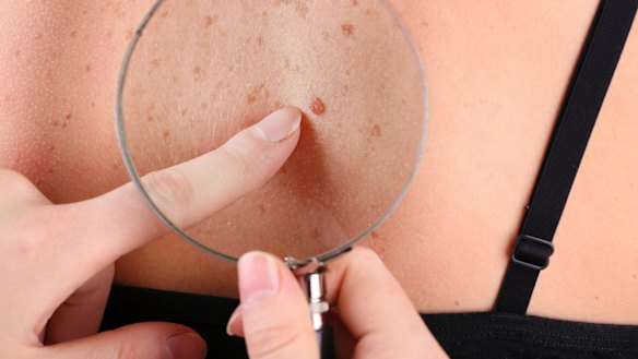The Australasian College of Dermatologists warns there is a shortage of skin cancer specialists in the country with the highest rate of melanoma in the world.