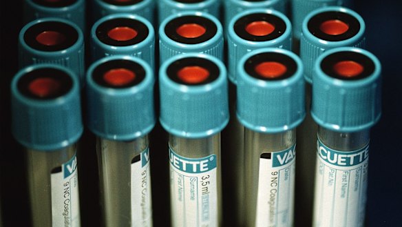 The ACCC is worried about the competition impact from combining Healius and Australian Clinical Labs.