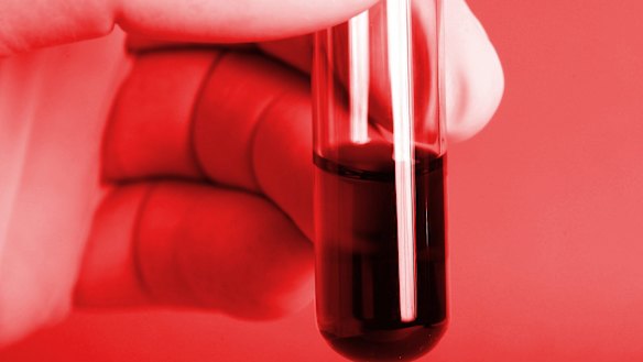 CSL will take a hit after moving to a direct distribution model in  China. 