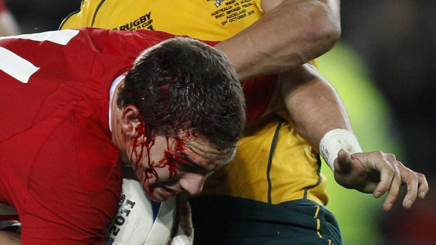 Red head: A bleeding George North is wrestled by a Wallaby.
